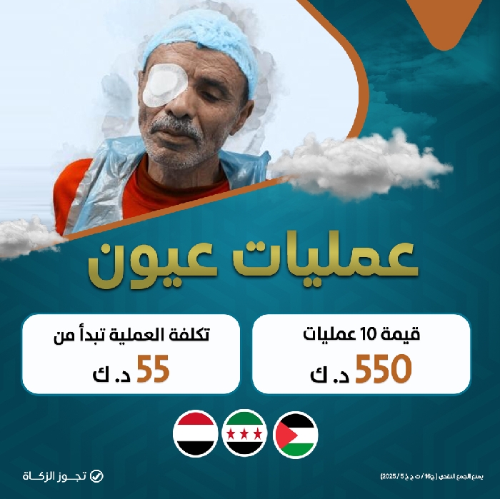 صورة عمليات عيون
